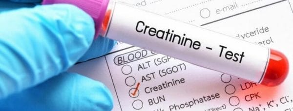 creatinine blood test medicalnewstoday