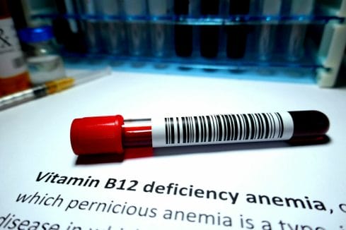 B-Vitamin Deficiency