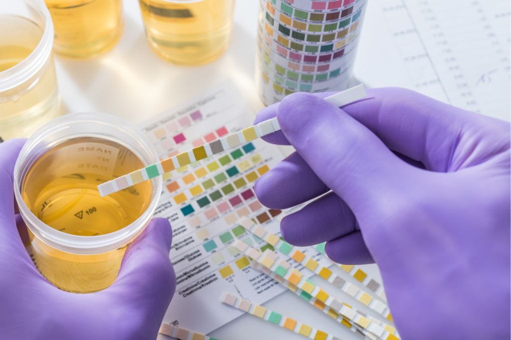 Chronic Kidney Disease Lab Tests: Values Explained | RenalTracker