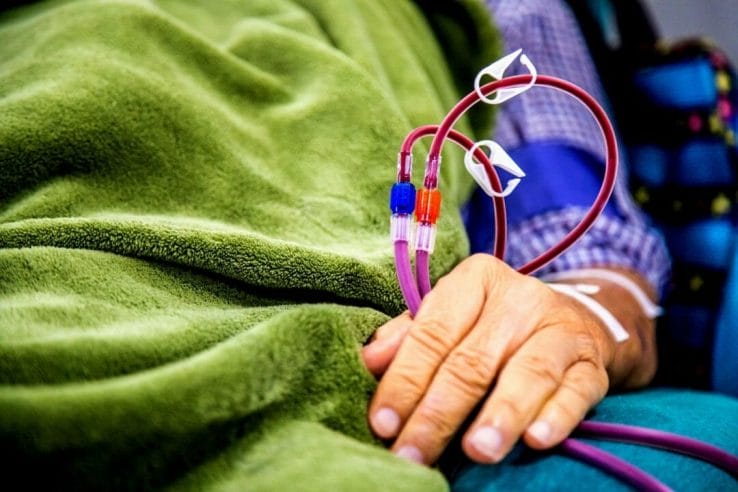 dialysis patient in bed getting dialysis dialysis patient in bed getting dialysis