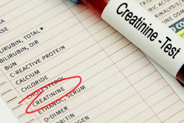 What is Creatinine_