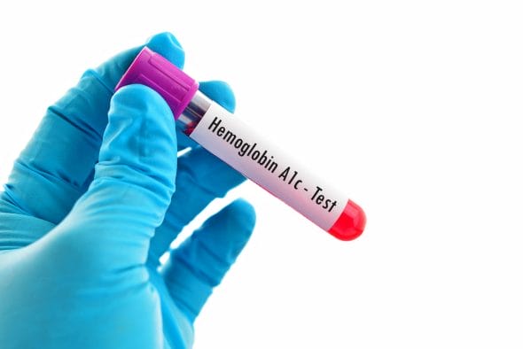 glycated hemoglobin (A1C) test